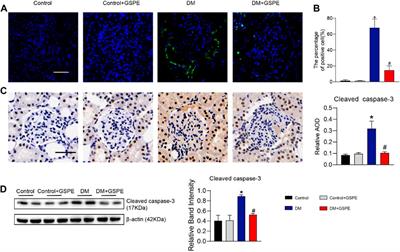 Grape seed proanthocyanidin extract targets p66Shc to regulate mitochondrial biogenesis and dynamics in diabetic kidney disease